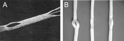 Endoproteza więzadła krzyżowego przedniego Leeds-Keio (A) oraz endoproteza więzadła krzyżowego przedniego Lars (B).